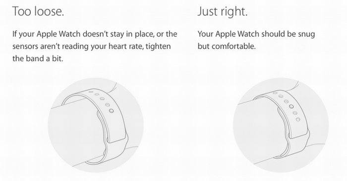 Irritálja a bõrödet az Apple Watch? Rosszul hordod!