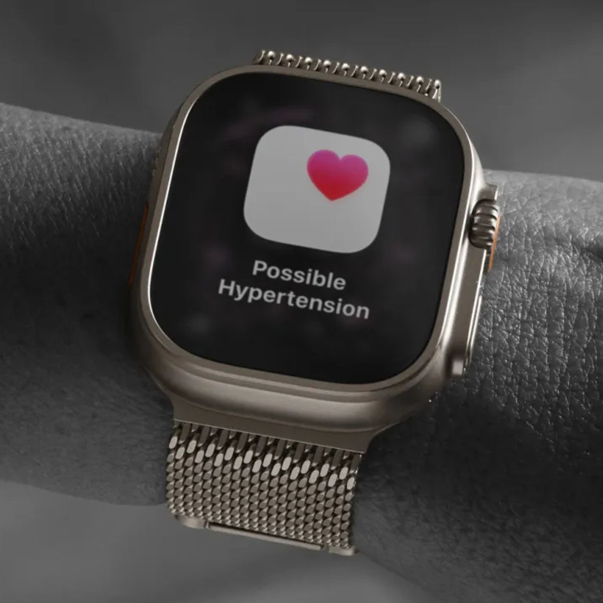 Újabb pofon az Apple-ellenes perben: a bíróság végleg elkaszálta az Apple Watch monopólium vádját