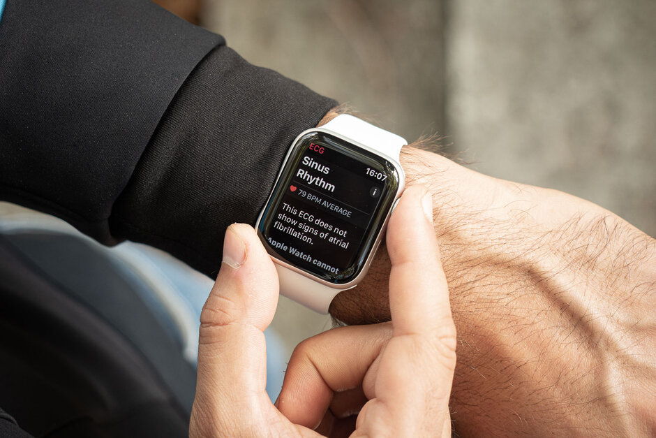 Bővítik az Apple Watch funkcióit